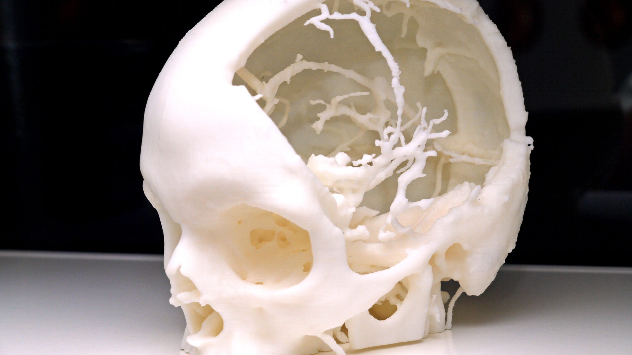 3D-Printed Healthcare: Devices Transforming Hospitals Forever